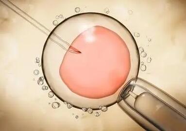 胎停与染色体的关系，美国试管婴儿技术分析